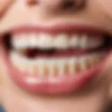 Close-up of orthodontic wax on dental brackets